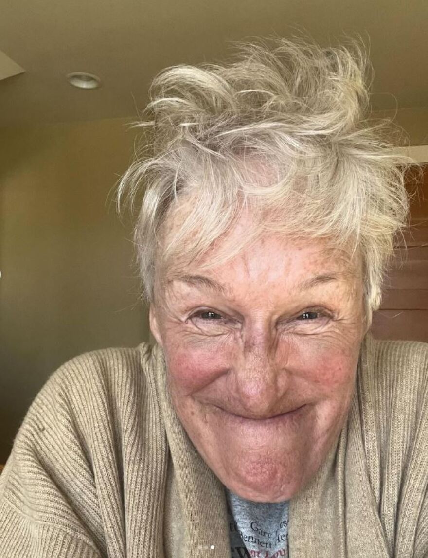 Γκλεν Κλόουζ: Χωρίς μακιγιάζ στο Instagram η ηθοποιός - Νιώθω πιο όμορφη από ποτέ, γράφει