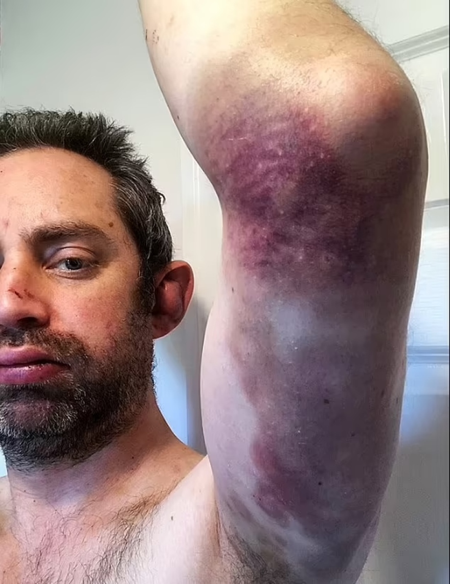 Βρετανία: Αποκάλυψε την άγρια κακοποίηση που δεχόταν από τη σύζυγό του επί 20 χρόνια και γίνεται ντοκιμαντέρ