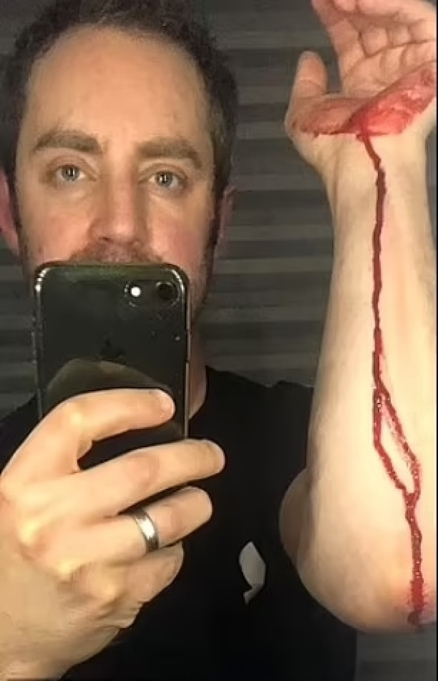 Βρετανία: Αποκάλυψε την άγρια κακοποίηση που δεχόταν από τη σύζυγό του επί 20 χρόνια και γίνεται ντοκιμαντέρ