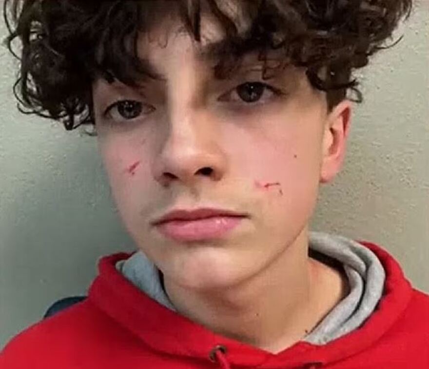 ΗΠΑ: Αδιανόητη συμπεριφορά από οδηγό λεωφορείου - Οι μαθητές γελούσαν και άρπαξε από τον λαιμό έναν 13χρονο