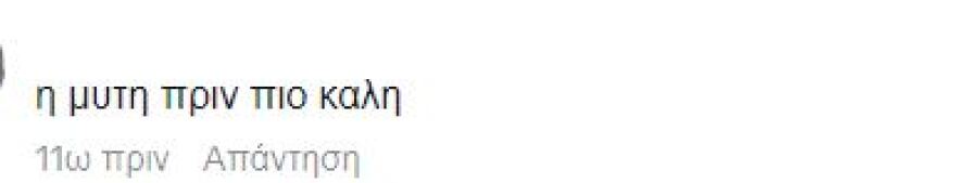Ιωάννα Τούνη: Η instagrammer πριν και μετά τις πλαστικές επεμβάσεις - Δείτε φωτογραφίες