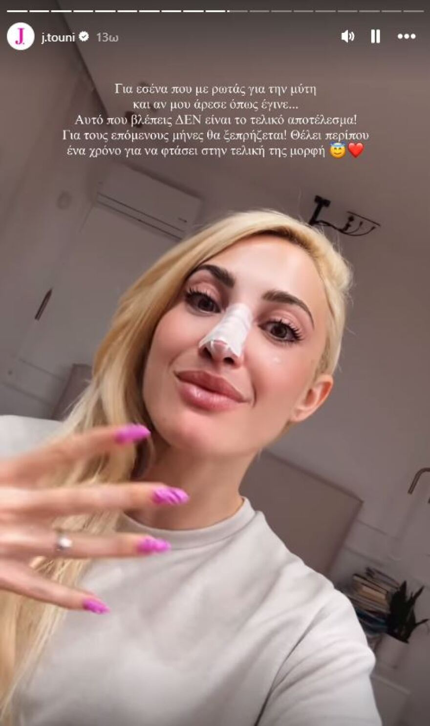 Ιωάννα Τούνη: Η instagrammer πριν και μετά τις πλαστικές επεμβάσεις - Δείτε φωτογραφίες