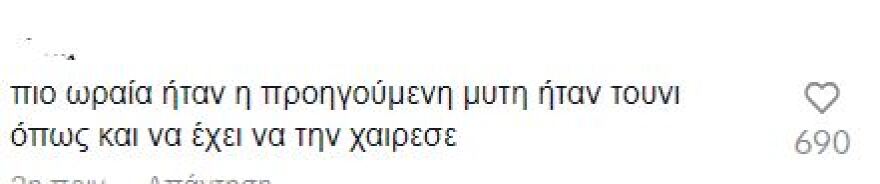 Ιωάννα Τούνη: Η instagrammer πριν και μετά τις πλαστικές επεμβάσεις - Δείτε φωτογραφίες