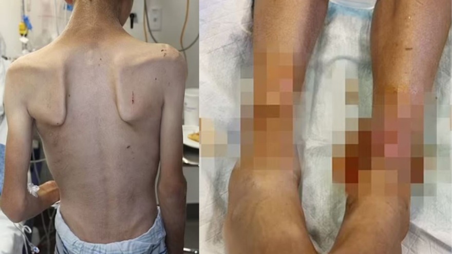 Ρούμπι Φράνκε: Κατέγραφε σε ημερολόγιο τα βασανιστήρια που έκανε στα παιδιά της η youtuber που θα σαπίσει στη φυλακή