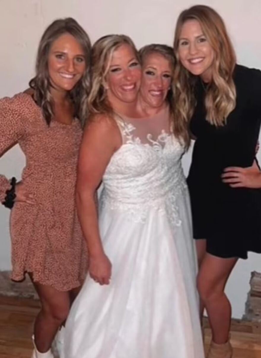 Abby και Brittany Hensel: Mία από τις πιο διάσημες σιαμαίες αδελφές των ΗΠΑ είναι πλέον παντρεμένη