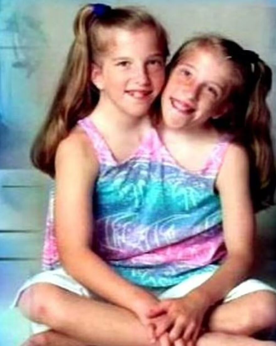 Abby και Brittany Hensel: Mία από τις πιο διάσημες σιαμαίες αδελφές των ΗΠΑ είναι πλέον παντρεμένη