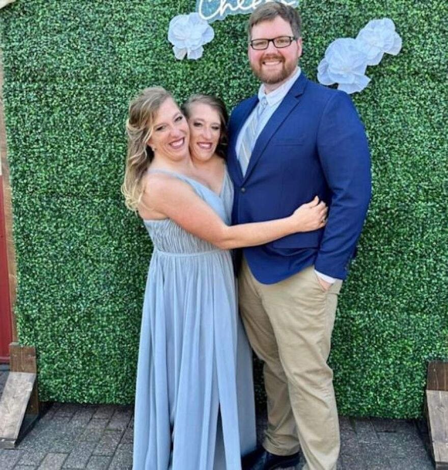 Abby και Brittany Hensel: Mία από τις πιο διάσημες σιαμαίες αδελφές των ΗΠΑ είναι πλέον παντρεμένη