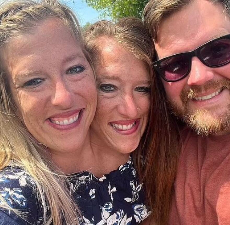 Abby και Brittany Hensel: Mία από τις πιο διάσημες σιαμαίες αδελφές των ΗΠΑ είναι πλέον παντρεμένη