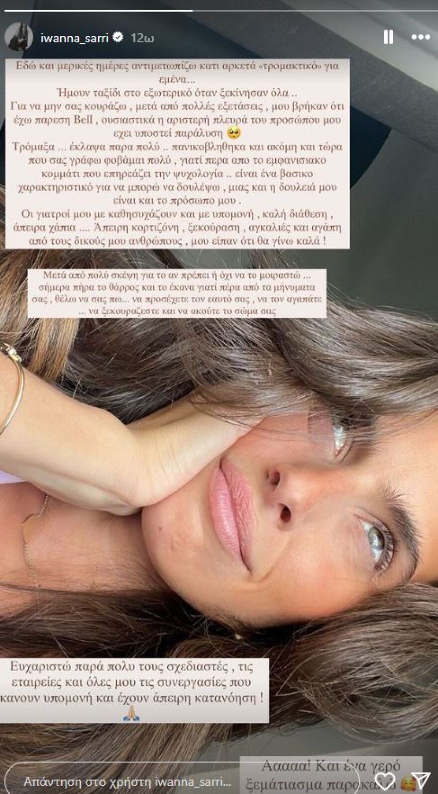 Ιωάννα Σαρρή: Μου έχει μείνει μόνιμος φόβος, αναφέρει για την πάρεση Bell που την ταλαιπώρησε