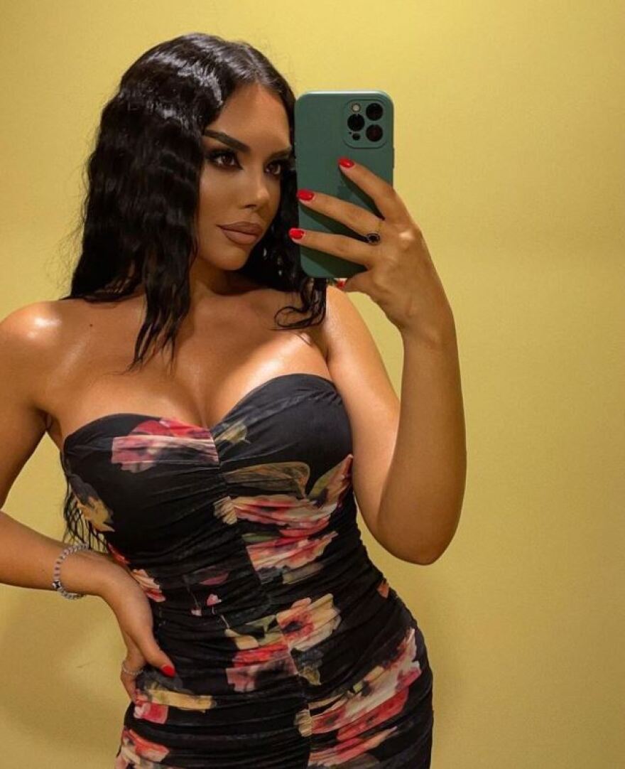 Μοντέλο από την Αλβανία προτρέπει τους διεθνείς ποδοσφαιριστές της χώρας της: Μην μου στέλνετε μηνύματα, παίξτε μπάλα 