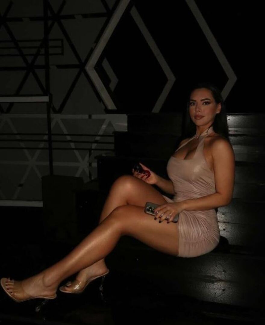 Μοντέλο από την Αλβανία προτρέπει τους διεθνείς ποδοσφαιριστές της χώρας της: Μην μου στέλνετε μηνύματα, παίξτε μπάλα 