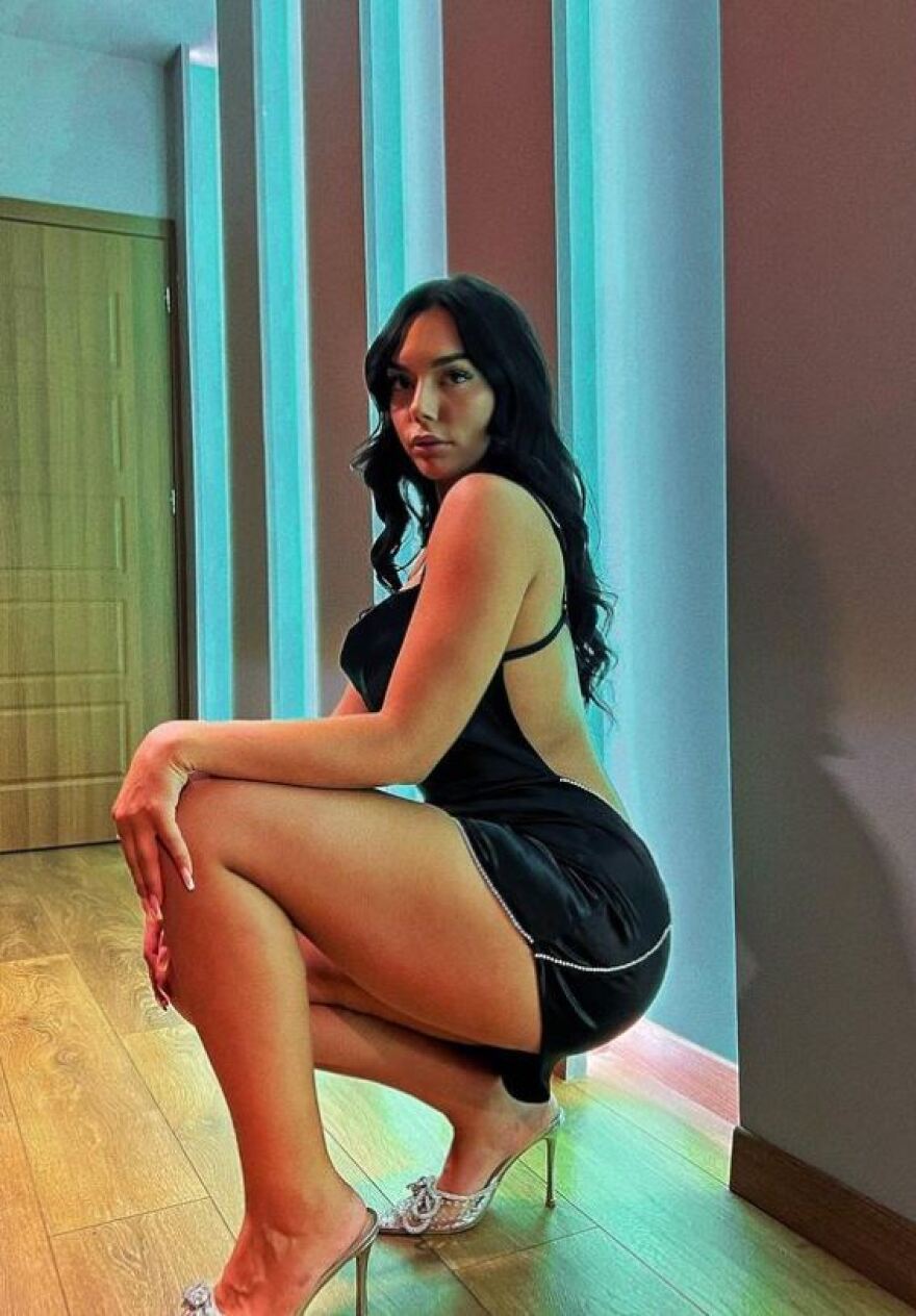 Μοντέλο από την Αλβανία προτρέπει τους διεθνείς ποδοσφαιριστές της χώρας της: Μην μου στέλνετε μηνύματα, παίξτε μπάλα 