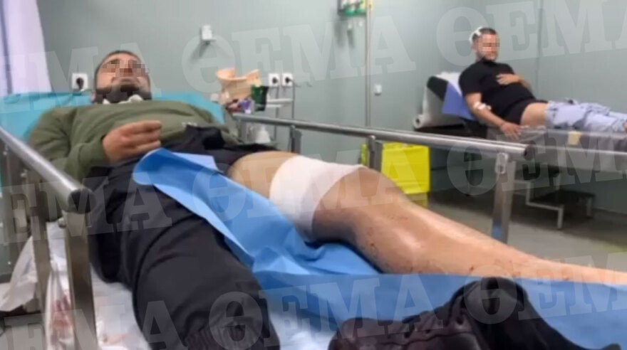 Νέα Φιλαδέλφεια: Άγρια επίθεση σε δύο αδέρφια - Τους χτύπησαν με ρόπαλα και τους μαχαίρωσαν 