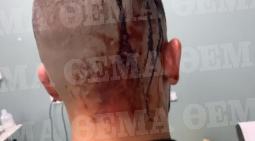 Νέα Φιλαδέλφεια: Άγρια επίθεση σε δύο αδέρφια - Τους χτύπησαν με ρόπαλα και τους μαχαίρωσαν 