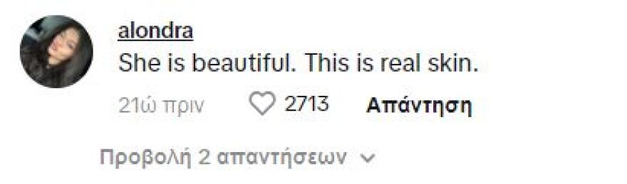 Κένταλ Τζένερ: Tο κοινό την επαινεί που εμφανίστηκε στο TikTok χωρίς μακιγιάζ και φίλτρα - Σε αγαπάμε, της γράφουν