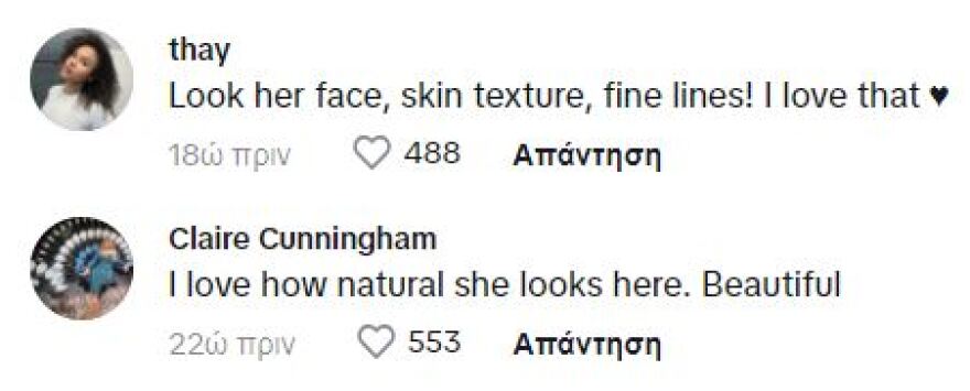 Κένταλ Τζένερ: Tο κοινό την επαινεί που εμφανίστηκε στο TikTok χωρίς μακιγιάζ και φίλτρα - Σε αγαπάμε, της γράφουν