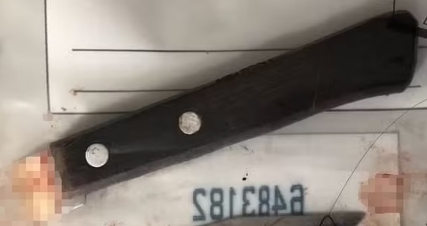 Βραζιλία: Τη μαχαίρωσε μέχρι θανάτου... επειδή του δάγκωσε το δάχτυλο ενώ έκαναν σεξ