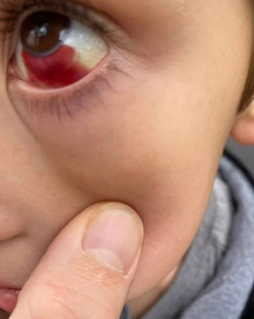 ΗΠΑ: «Πρέπει να σκληρύνει» έγραφε ο πατέρας που κακοποίησε τον 6χρονο γιο του σε διάδρομο γυμναστηρίου