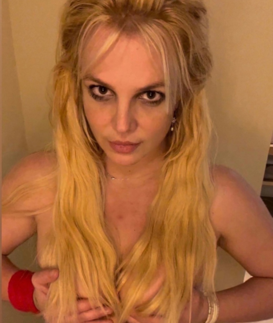 Μπρίτνεϊ Σπίαρς: Ισχυρίστηκε ότι υπέστη σοβαρή νευρική βλάβη