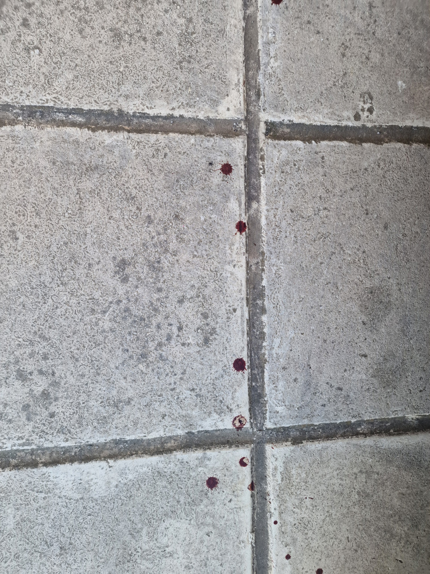 Θεσσαλονίκη: «Έκανε κομμάτια το σκυλάκι» - Συγκλονίζει περιγραφή για την επίθεση που δέχθηκε γυναίκα από πίτμπουλ