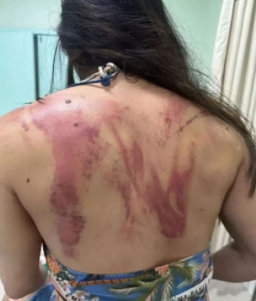 Βραζιλία: 54χρονος χτύπησε την 33χρονη κόρη του με ματσέτα επειδή δεν ήθελε να του δώσει €165 για επισκευές σε αυτοκίνητο