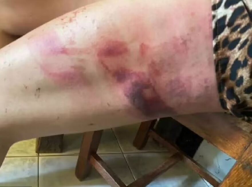 Βραζιλία: 54χρονος χτύπησε την 33χρονη κόρη του με ματσέτα επειδή δεν ήθελε να του δώσει €165 για επισκευές σε αυτοκίνητο