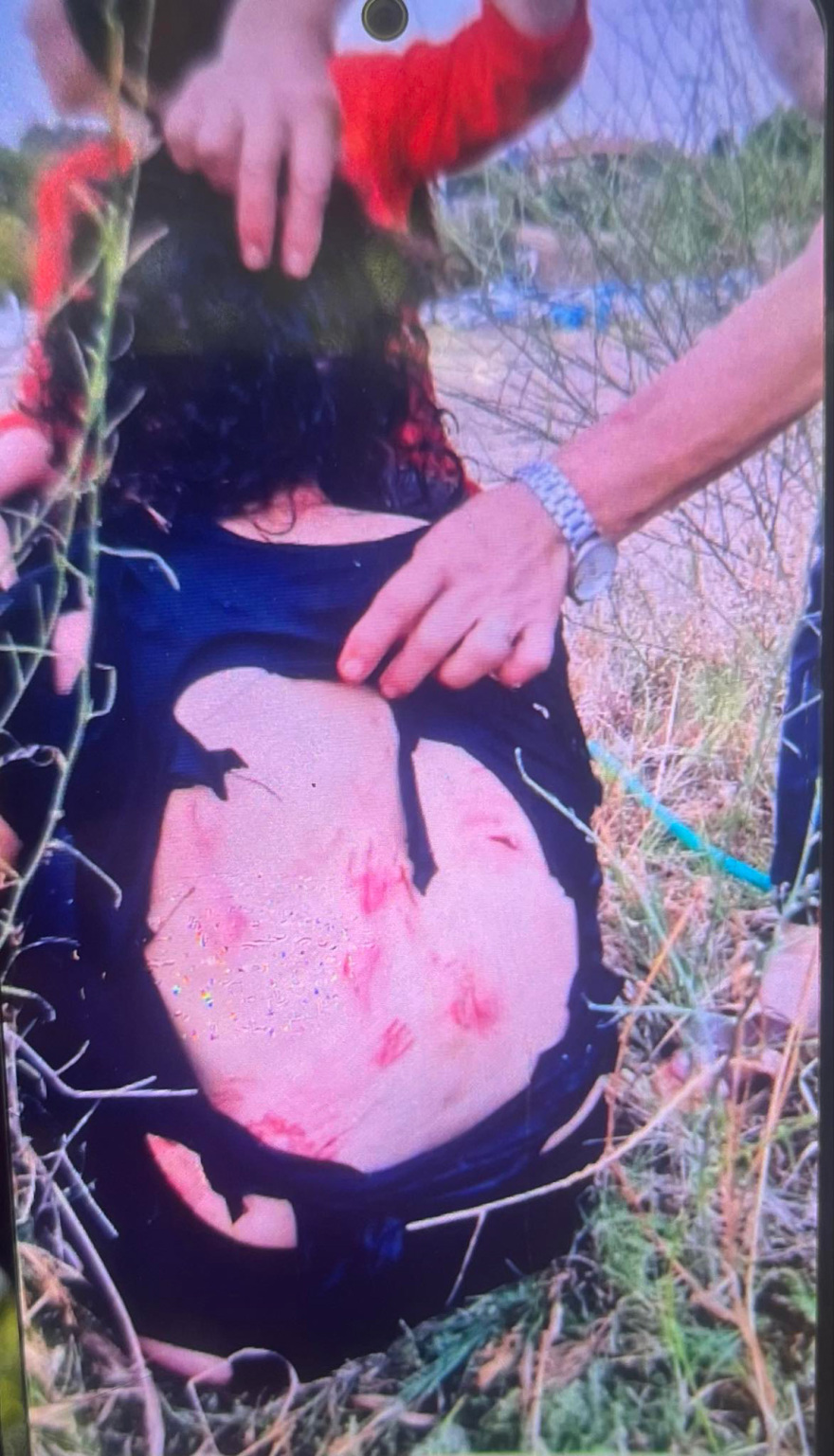 Θεσσαλονίκη: «Δέκα σκυλιά τη δάγκωναν όπου έβρισκαν», λέει η κόρη της 44χρονης που δέχθηκε επίθεση από αδέσποτα