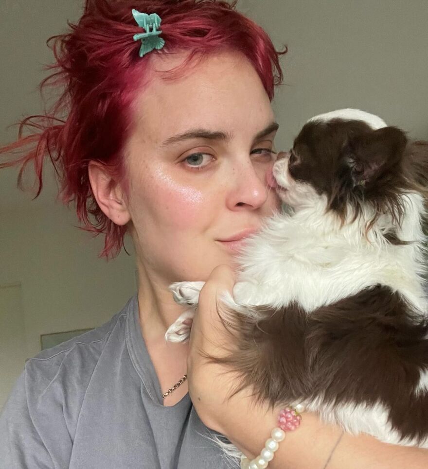 Ταλούλα Γουίλις: Μίλησε για την ψυχαναγκαστική διαταραχή από την οποία πάσχει - Σκαλίζει το δέρμα της