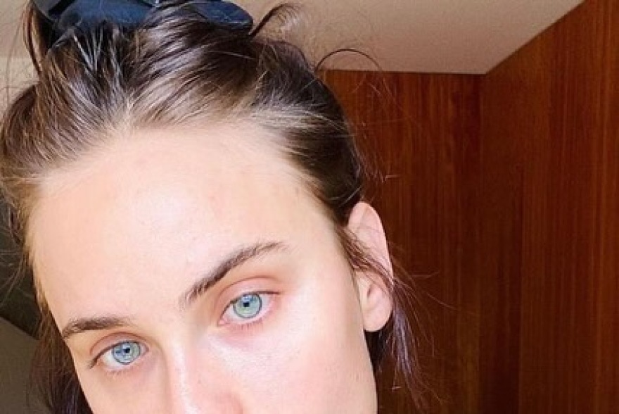 Ταλούλα Γουίλις: Μίλησε για την ψυχαναγκαστική διαταραχή από την οποία πάσχει - Σκαλίζει το δέρμα της