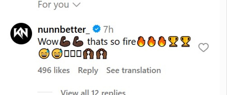 Οπαδός του Παναθηναϊκού έκανε τατουάζ τον Ναν χωρίς τα τρία δόντια