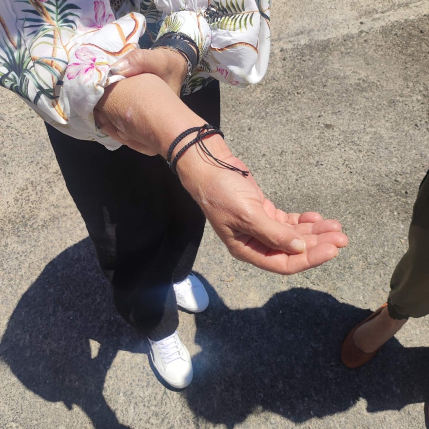 Πυρκαγιά Βάρης - Κορωπίου: Μετά το ξύλο στον δημοσιογράφο του protothema.gr έδειραν και μια γυναίκα