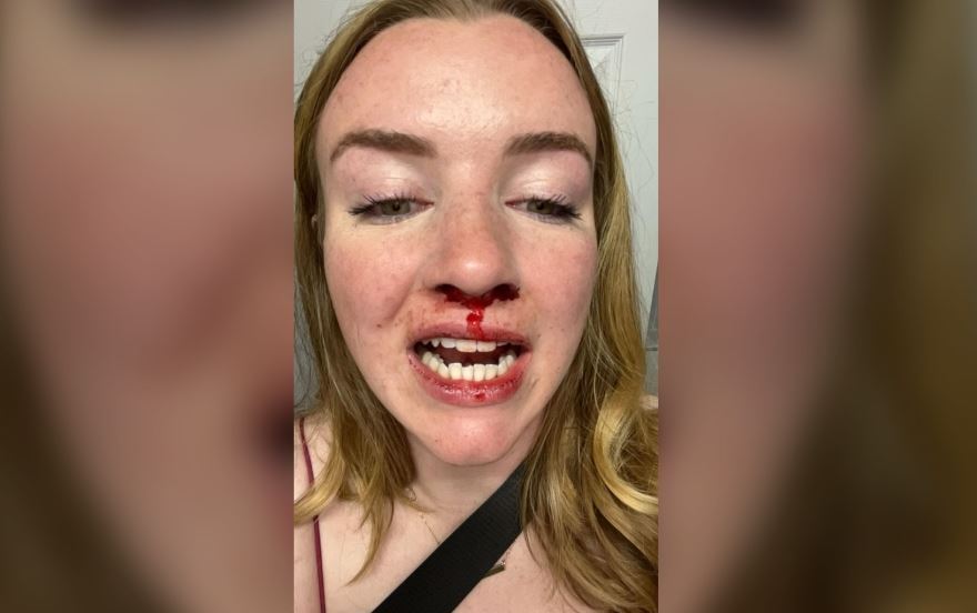 Καναδάς: Ζευγάρι ομοφυλόφιλων γυναικών δέχθηκε επίθεση από ομάδα 10 ανδρών αφού αντέδρασε σε ομοφοβικά σχόλια