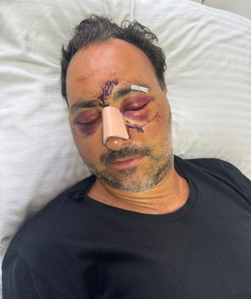 «Βρεθήκαμε στην κόλαση, θέλουμε δικαιοσύνη» λέει η σύζυγος του Ελληνοκαναδού που ξυλοκοπήθηκε στο Ηράκλειο