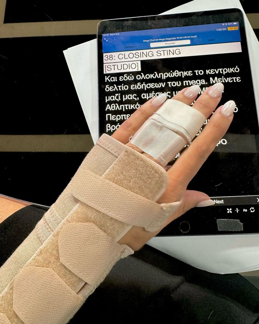Κατερίνα Παναγοπούλου: Οι διακοπές φέτος ξεκινούν με ένα σπασμένο χέρι και παρακάλια στον γιατρό - Δείτε την ανάρτησή της