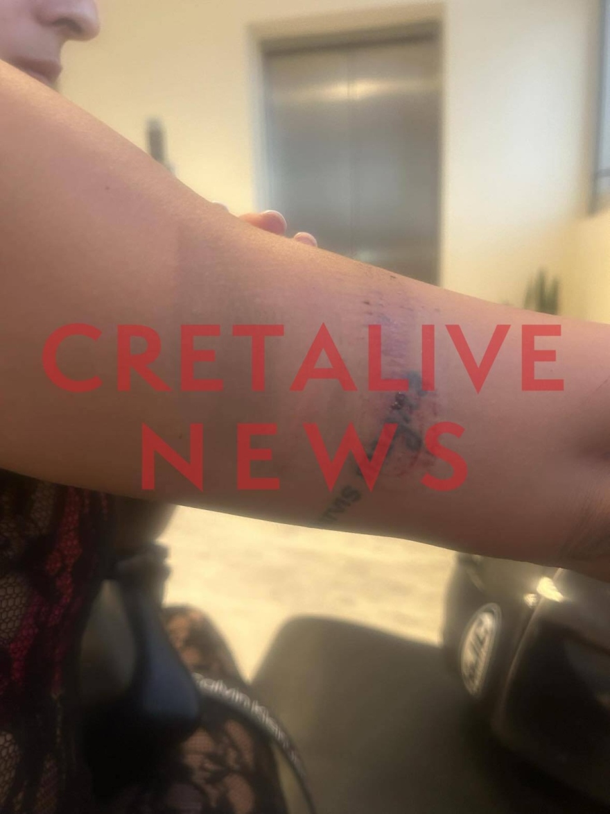 Κρήτη: Οδηγός φωτογράφισε κρυφά τα οπίσθια 25χρονης, την χτύπησε με το μηχανάκι και την έσυρε στο οδόστρωμα