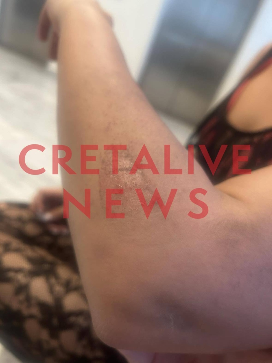 Κρήτη: Οδηγός φωτογράφισε κρυφά τα οπίσθια 25χρονης, την χτύπησε με το μηχανάκι και την έσυρε στο οδόστρωμα