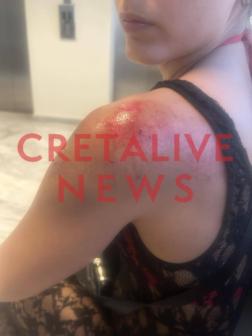 Κρήτη: Οδηγός φωτογράφισε κρυφά τα οπίσθια 25χρονης, την χτύπησε με το μηχανάκι και την έσυρε στο οδόστρωμα