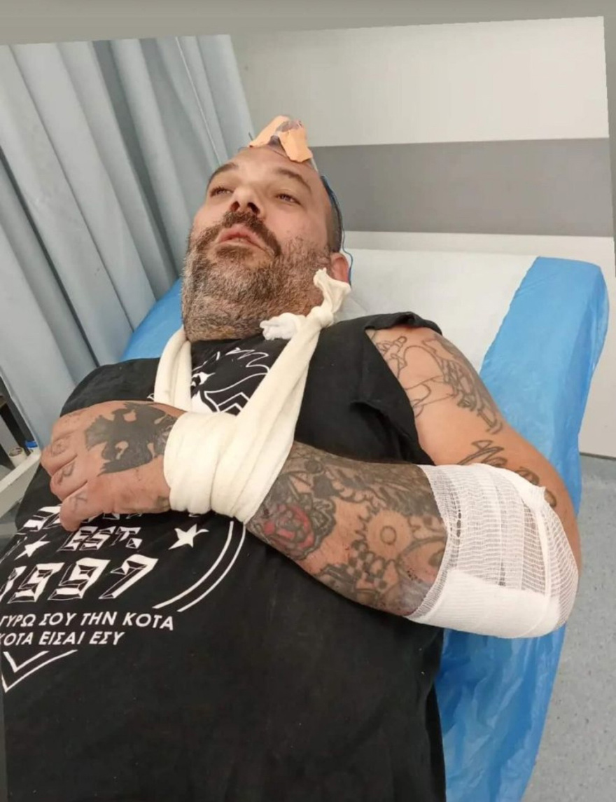 Λεωφόρος Ποσειδώνος: Θύμα τροχαίου με εγκατάλειψη πρώην διαγωνιζόμενος του GNTM - Εκτινάχθηκε στις μπάρες