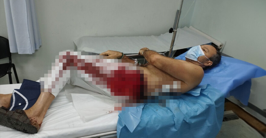 Φωτογραφία σοκ από άγρια επίθεση νεαρών με μαχαιριές σε 54χρονο στο Μαρούσι