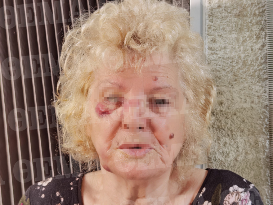 Βύρωνας: «Φοβόμουν μη με σφάξει» λέει η 86χρονη που ήρθε αντιμέτωπη με τον ίδιο ληστή δύο φορές την ίδια ημέρα