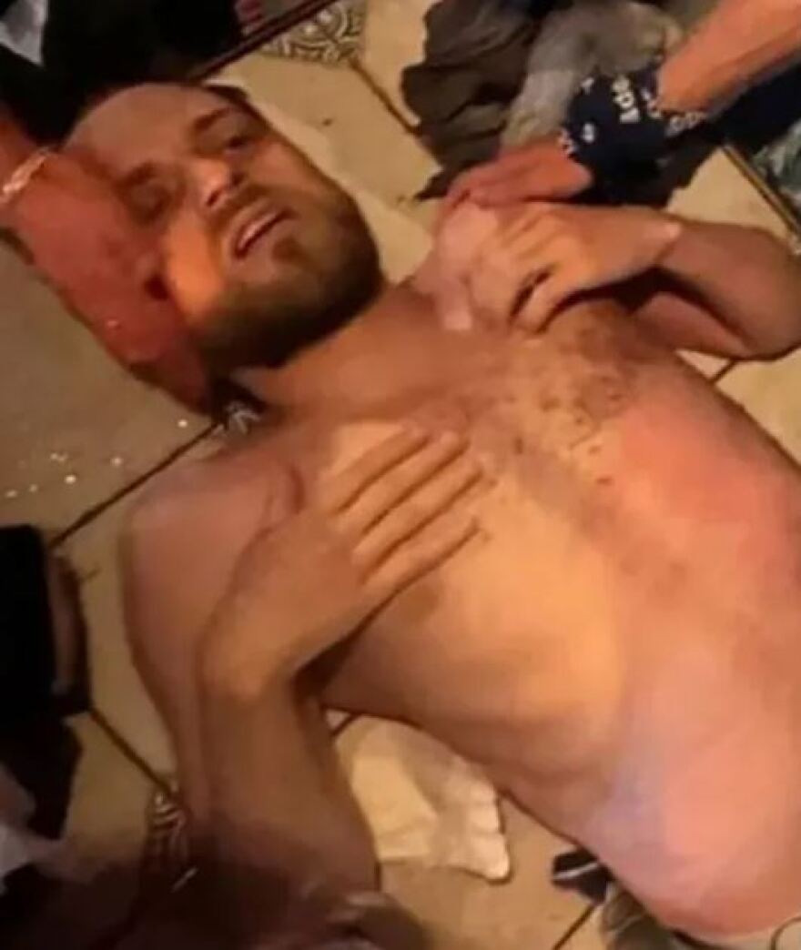 Γεωργία: Η στιγμή που κεραυνός χτυπάει 32χρονο στη Γεωργία - «Ένιωσα ότι πεθαίνω»