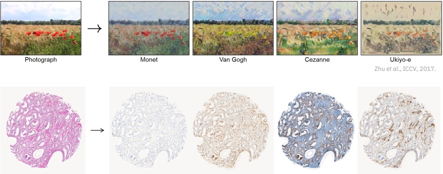 Ελληνίδα επικεφαλής ομάδας που δημιούργησε μοντέλο τεχνητής νοημοσύνης για την παθολογική ανάλυση του καρκίνου