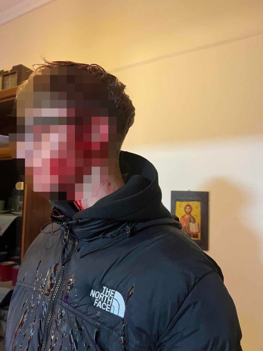 Ανήλικοι κυκλοφορούν με φαλτσέτες και στοχοποιούν παιδιά μέσω Internet - Ο Γολγοθάς της 14χρονης στη Γλυφάδα