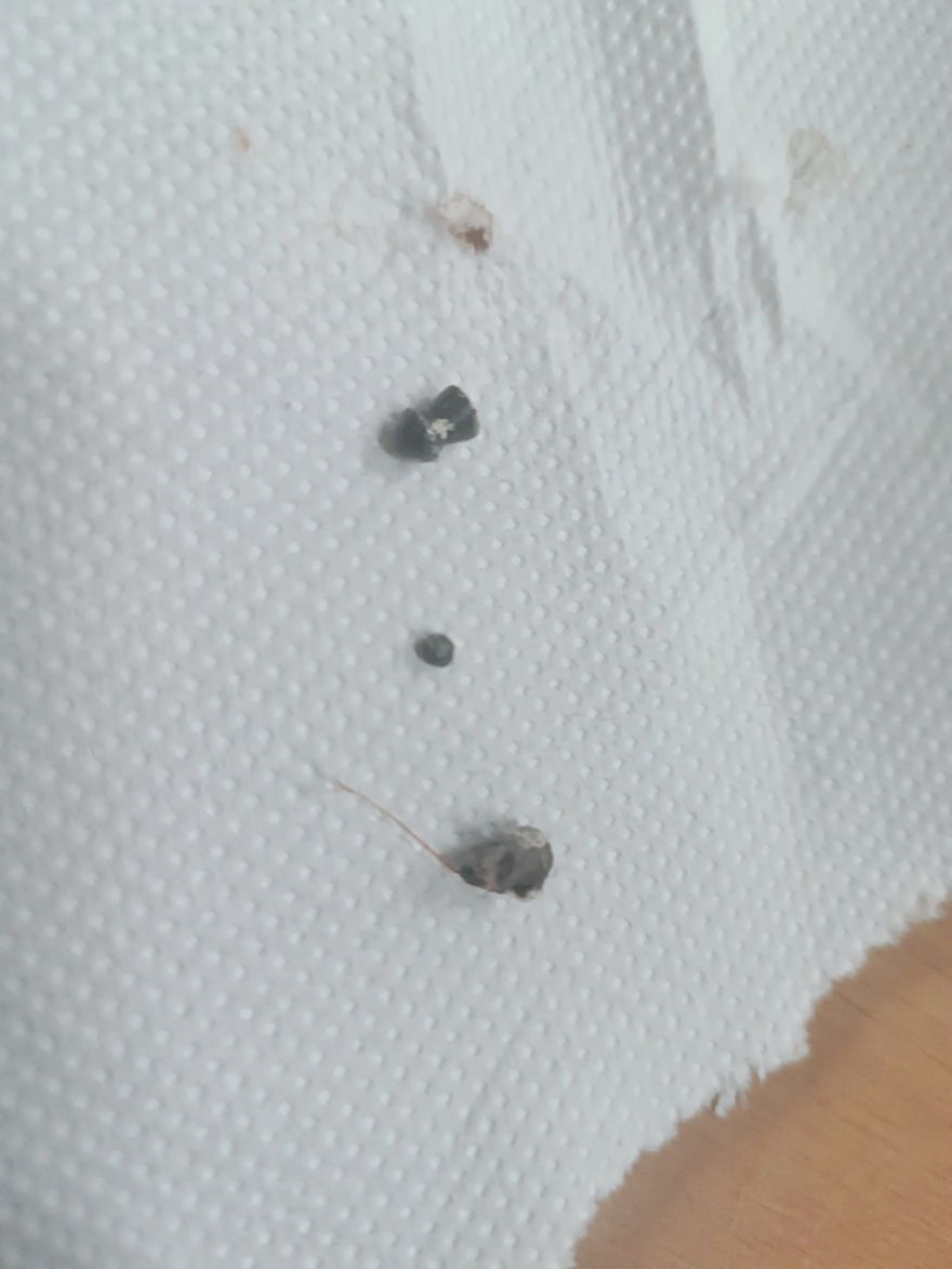 Κρήτη: Άγνωστοι πυροβόλησαν παγώνι στην Κνωσό