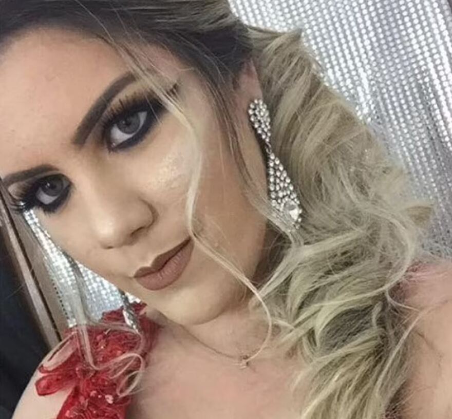 Βραζιλία: 24χρονη πέθανε αφού έκανε έξι πλαστικές επεμβάσεις σε μια ημέρα