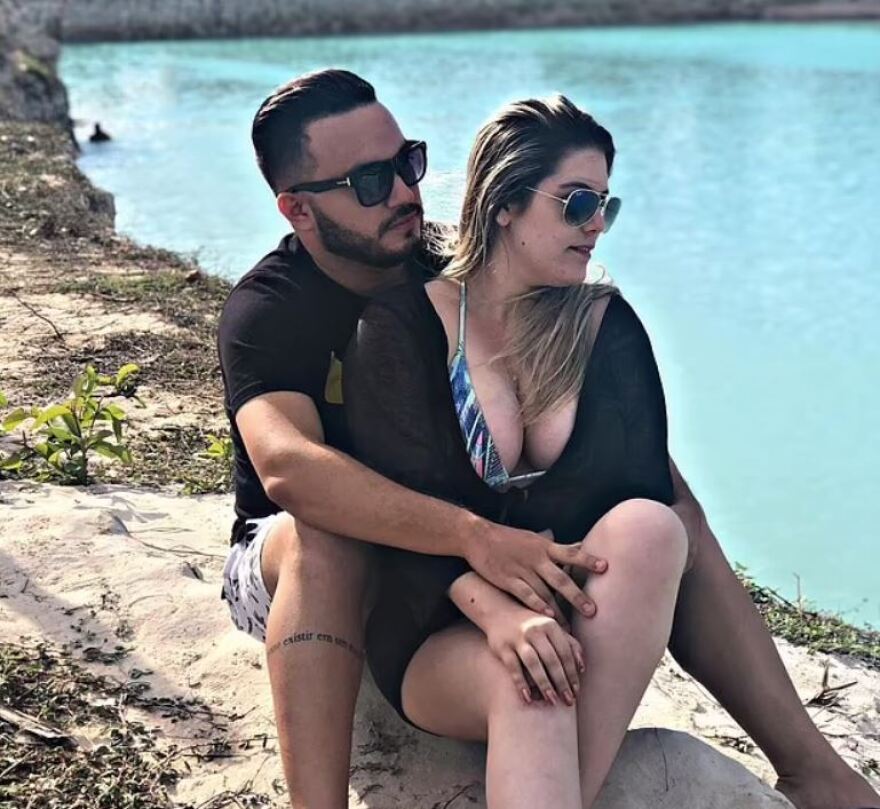 Βραζιλία: 24χρονη πέθανε αφού έκανε έξι πλαστικές επεμβάσεις σε μια ημέρα