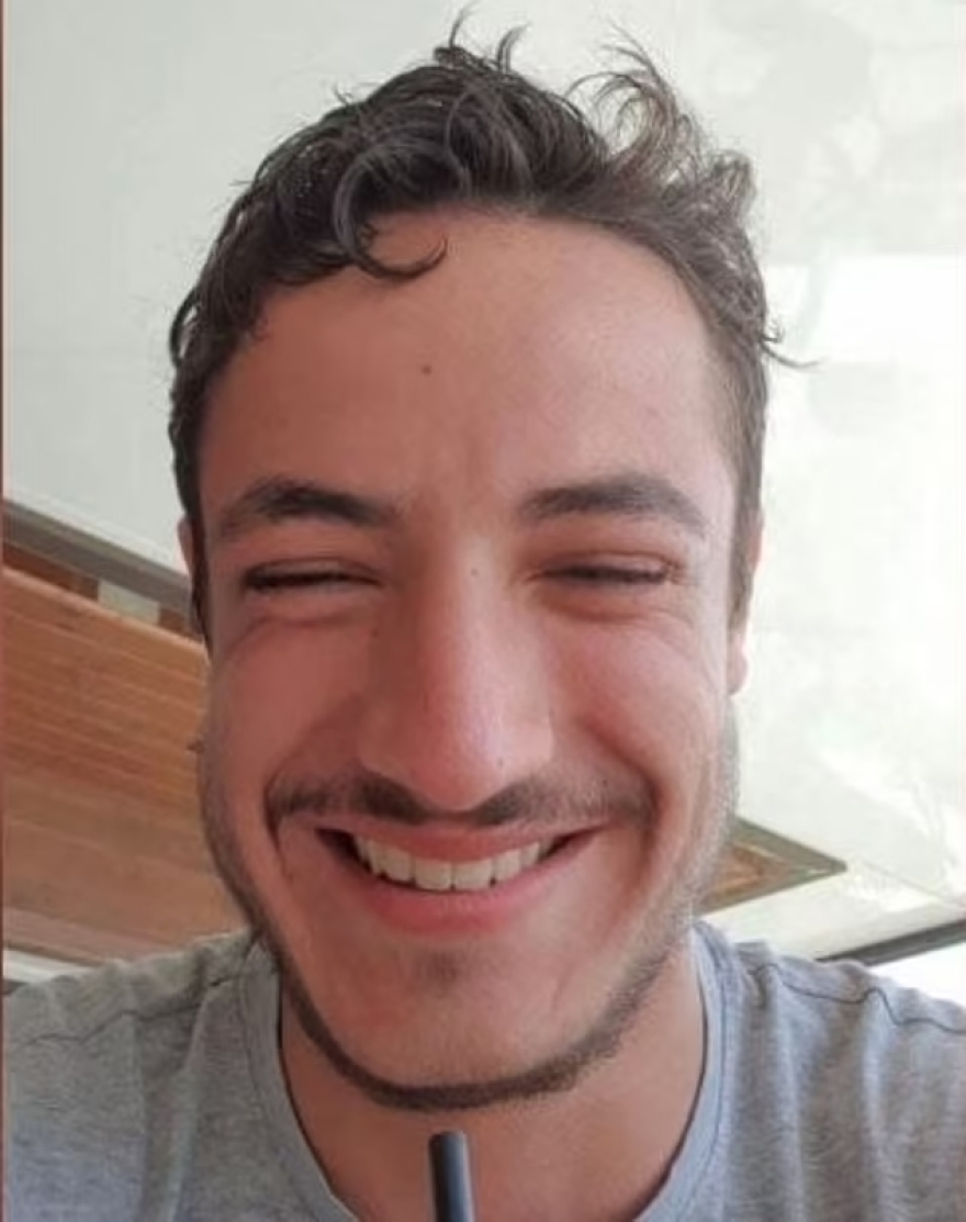 Γαλλία: 24χρονος αυτοκτόνησε μετά από αποτυχημένη επέμβαση για μούσια στην Κωνσταντινούπολη