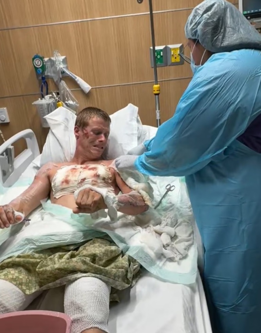 Φοίνιξ: Αστυνομικοί προκάλεσαν εγκαύματα τρίτου βαθμού σε 30χρονο στο Φοίνιξ - Τον έριξαν στο έδαφος ενώ είχε 45,5℃