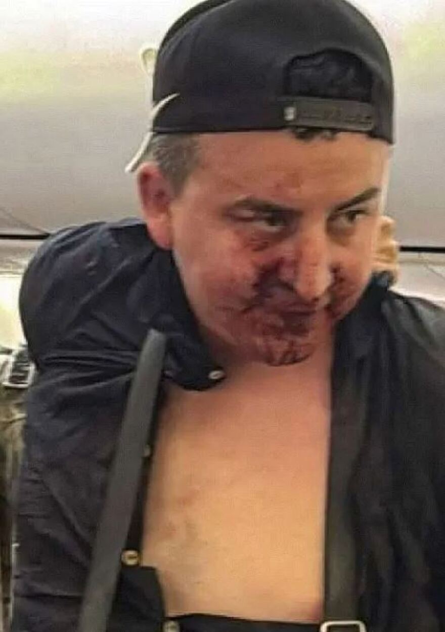 Παναμάς: Χαμός σε πτήση - Επιβάτης προσπάθησε να ανοίξει την έξοδο κινδύνου και ξυλοκοπήθηκε 