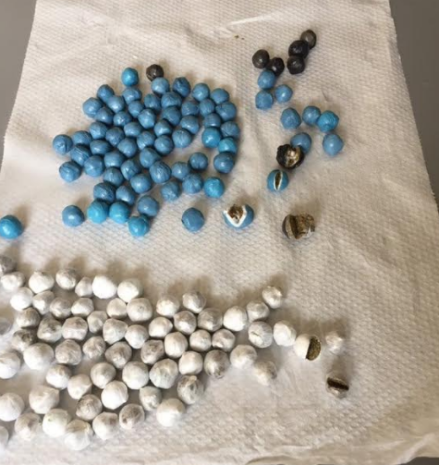 Είχε χασίς και στην κοιλιά του ο κρατούμενος  με τα σαμπουάν